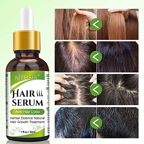 Serum Crecimiento Cabello, Antipérdida de Cabello, para Acelerar el Crecimiento del Cabello, Promueve más Cabello Ticker, más Completo y más Rápido Crecimiento,Crece Pelo para Hombre y Mujer (30ML)