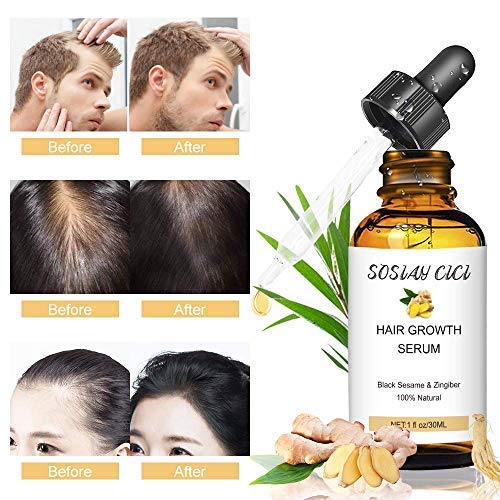 Sérum de Crecimiento del Cabello, Anticaida de Cabello, Tratamiento para el Cabello, Promueve más cabello ticker, Crecimiento Cabello para Hombres y Mujeres 30ml