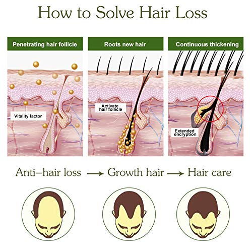 Sérum de crecimiento del cabello, antipérdida de cabello, para acelerar el crecimiento del cabello, promueve más cabello ticker, más completo y más rápido crecimiento
