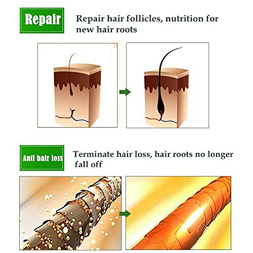 Sérum de crecimiento del cabello, tratamiento para el cabello y fortalece los folículos para el crecimiento del cabello, ayuda al crecimiento del cabello.