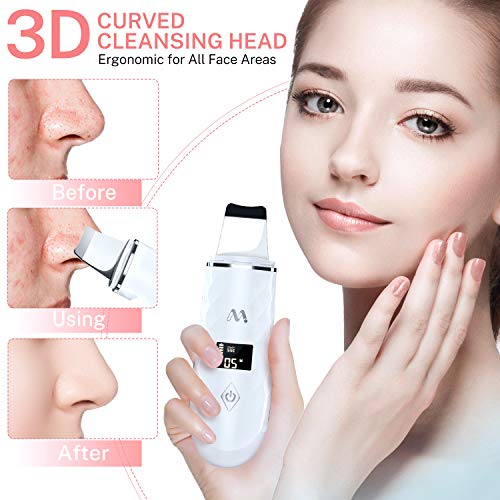 Skin Scrubber, Misiki Peeling Ultrasónico Facial Skin Scrubber Exfoliación Facial Ultrasónica Limpiador de Poros para Limpieza Facial y Cuidado Facial