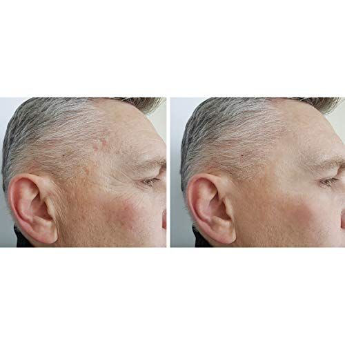 SUERO DE REJUVENECIMIENTO INSTANTÁNEO DE LA CARA IMMACULIFT - REJUVENECIMIENTO INSTANTÁNEO DE OJOS - REMUEVE ARRUGAS - FUNCIONA EN MINUTOS Y DURA HORAS