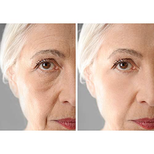 SUERO DE REJUVENECIMIENTO INSTANTÁNEO DE LA CARA IMMACULIFT - REJUVENECIMIENTO INSTANTÁNEO DE OJOS - REMUEVE ARRUGAS - FUNCIONA EN MINUTOS Y DURA HORAS
