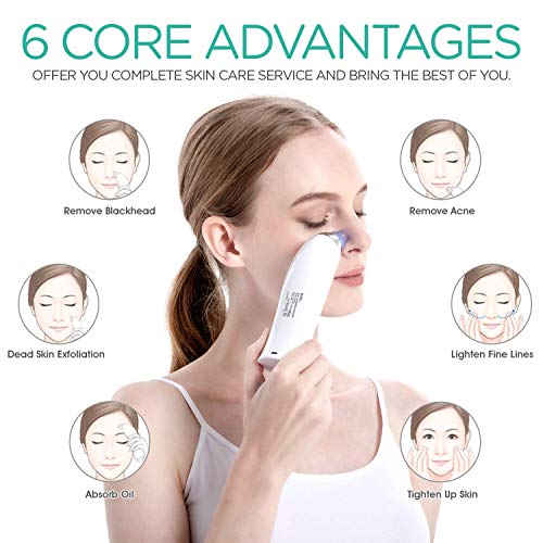 UMI by Amazon limpiador de poros electrico Succionador de puntos negros y limpiador facial de poros con pantalla LCD y cuatro cabezales extraíbles 5 Velocidades Potente Extractor, lanco