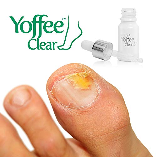 Yoffee - Yoffee Clear - Purity Nail - Antibacteriano y antiséptico, Tratamiento de Uñas de los hongos, Apto para dedos y pedicura, con Árbol de Té y Aceite de Argán (10ml)