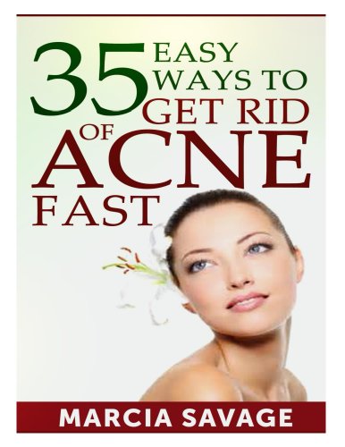 35 Easy Ways To Get Rid Of Acne Fast (English Edition)