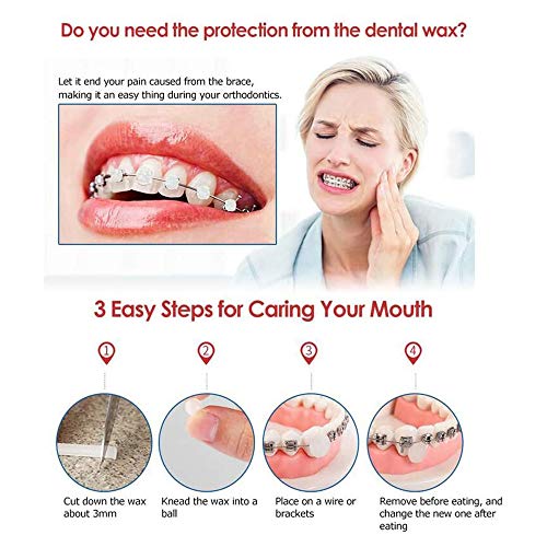8 piezas de Cera Dental, Cera para El Alivio de La Irritación, Cera para El Cuidado Bucal Dental, Varios Aromas de Frutas, para Protector del Usuario de Aparatos Ortopédicos, Ortodoncia Dental