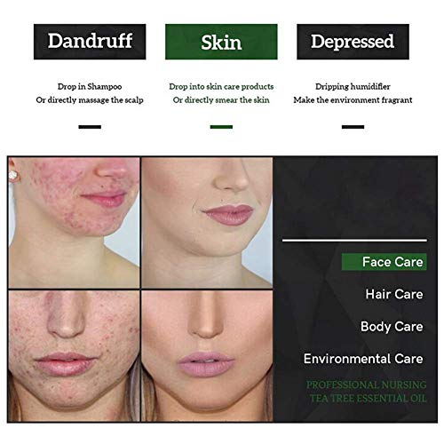 Aceite esencial de árbol de té, Tea Tree Oil,Aceite Esencial de Arbol de Te, Alivia las irritaciones comunes de la piel,la piel seca y agrietada,las cutículas y las espinillas,anti-acné