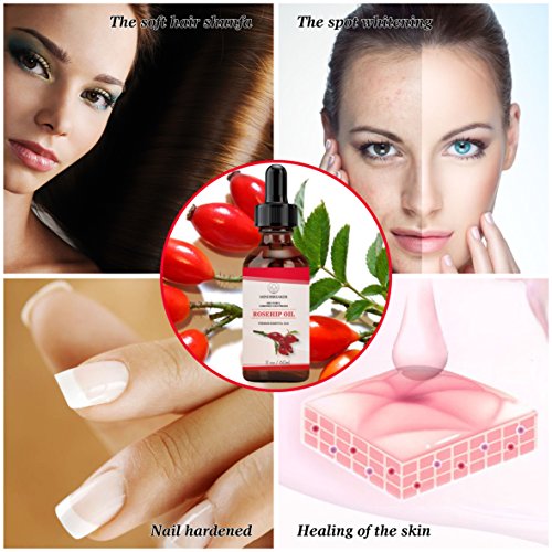 Aceite Orgánico de Rosa Mosqueta 100% Puro y Natural, para Piel, las uñas, el cabello (60ml)