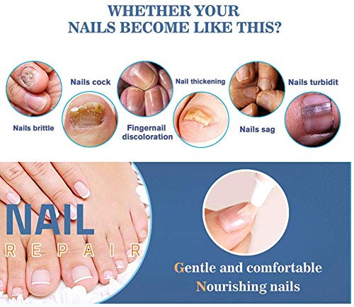 Aceite Para Uñas, Tratamiento De Uñas, Aceite Nutritivo Líquido, Pluma De Reparación De UñasPromueve Rebrote De Uñas Sanas Cuidado De La Reparación Natural Y Seguro