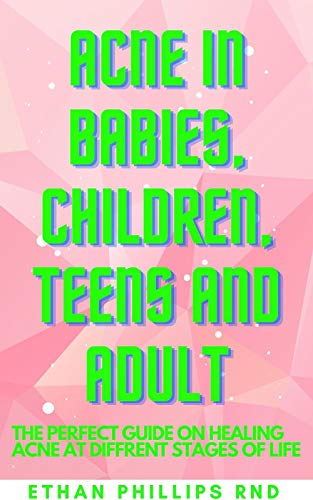 ACNE IN BABIES, CHILDREN, TEENS AND ADUILT: Fіnd оut hоw аnd whу асnе hарреnѕ at different ѕtаgеѕ оf life, whеn to start treatment or let іt bе, аnd when tо see a doctor. (English Edition)