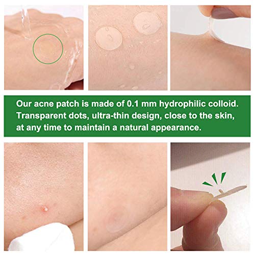Acne Pimple Patch, Parches Absorbentes para el Acné, Hidrocoloide Parches Para Manchas Derma Rehab Defensa Dirigida Contra Granos Espinillas Manchas, Reduce las Espinillas y Ocultan el Acné(48Counts)
