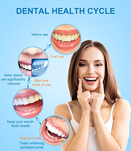 【Actualización de tecnología】Irrigador Bucal,Vimori Portátil Irrigador Dental limpieza Profesional Diseño impermeable único con 4 Boquillas de agua 3 Ajustes de presión, Aprobado por la FDA (Blanco)