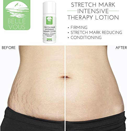 Antiestrias Crema - (100 ml) Organicos y Naturales Crema Estrias Embarazo - Reduzca las estrías y cicatrices de la cirugía, Embarazo y cicatrices queloides - Loción de terapia intensiva orgánica natural