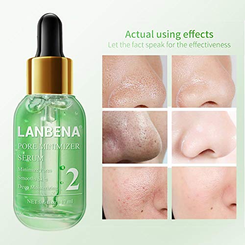 Ardentity Essence Reencoge, quitaesmalte de cabeza negra para aceite y acné para aceite, limpiador en profundidad y encoge los poros