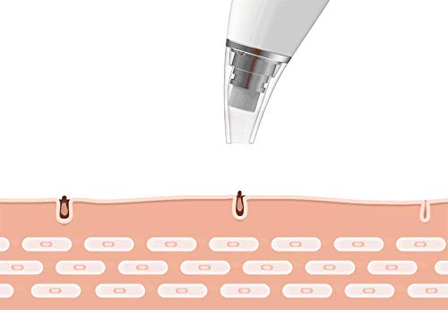 Aspiradora eléctrica MIJIA InFace Blackhead Remover con 2 modos para mujeres Hombre Cara Nariz Limpieza profunda