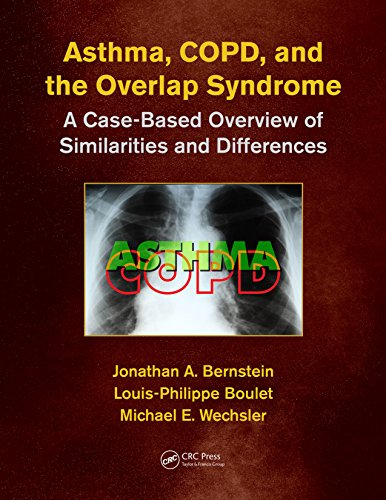 Asthma, COPD, and Overlap: A Case-Based Overview of Similarities and Differences (English Edition)