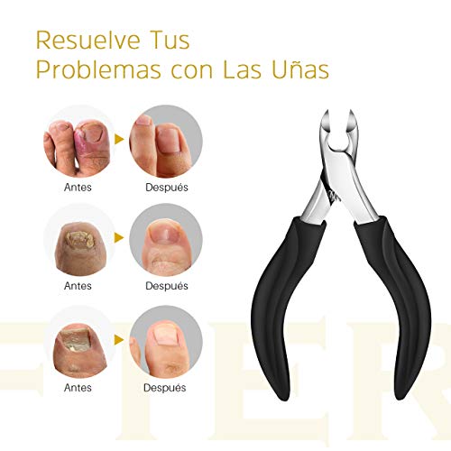 ATMOKO Alicates Cortaúñas Profesional 5 en 1 , Pinzas para Uñas Gruesas y Duras, Paroniquia, Onicomicosis, Hongos en las Uñas, Pedicura y Herramientas de Manicura, Preciso y Seguro