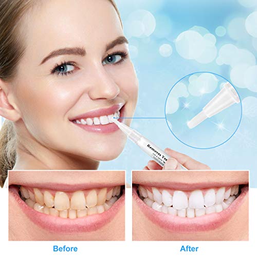 Blanqueamiento de dientes, Nivlan 4 PCS Sin Sensibilidad Gel Blanqueador Dental, Teeth Whitening Pen Profesional para las Manchas Higiene Oral