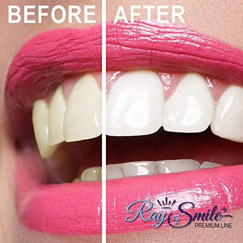 Blanqueamiento dental de Carbón Activado 100% Natural y puro | 60 g de Carbón Activo en polvo | Refresca el aliento | Activated charcoal de RAY OF SMILE Premium Line