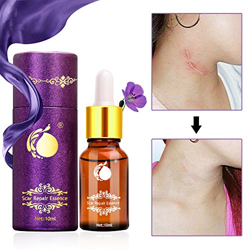 Cicatrices Tratamiento Aceite de Lavanda,Aceite para Reparación de Cicatrices Reparación de piel Dañada,Cicatrizante para el Acné y Estrías.