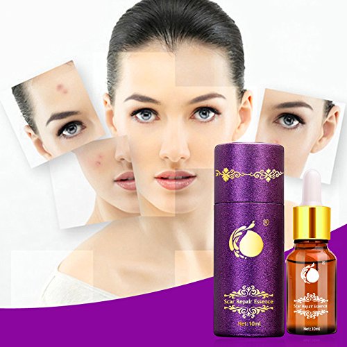 Cicatrices Tratamiento Aceite de Lavanda,Aceite para Reparación de Cicatrices Reparación de piel Dañada,Cicatrizante para el Acné y Estrías.