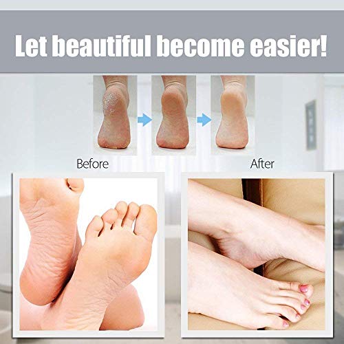 Coomatec Extrarugosos Rodillos Lijadores para Recambio de Scholl Velvet Smooth Diamond Crystals/Lima Electrónica Velvet Smooth Wet&Dry[Set de 10]