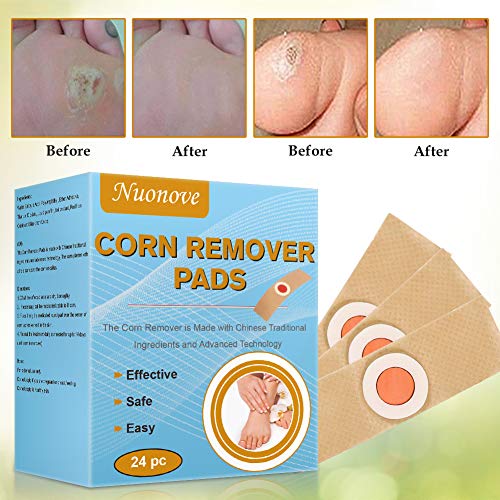 Corn Remover, Eliminar Verrugas, Eliminación de Callos, Eliminar Durezas Y Callos, tratamiento de eliminación de verrugas, removedor de maíz, 24PC