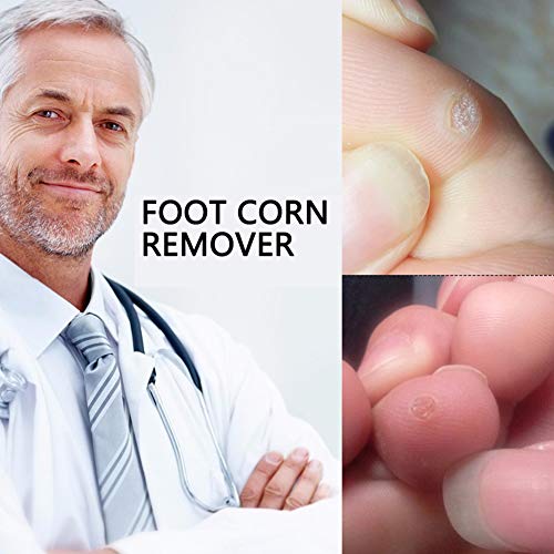 Corn Remover, Eliminar Verrugas, Eliminación de Callos, Eliminar Durezas Y Callos, tratamiento de eliminación de verrugas, removedor de maíz, 24PC