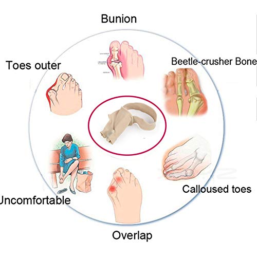 Corrector ortopédico para alivio de juanetes, separadores de dedos, grande, férula, para dolor de pies y Hallux Valgus