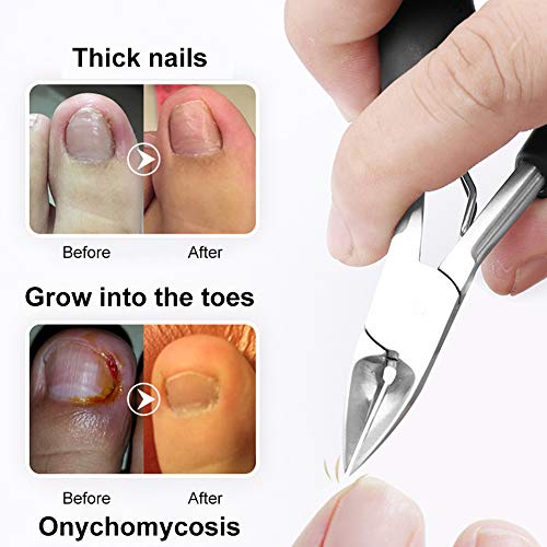 Cortauñas Profesional, Pedicura Cortaúñas, Cortaúñas Grande, Alicates Cortauñas Profesional, Pinzas para Uñas Gruesas y Duras, Paroniquia, Onicomicosis, Hongos en Las Uñas