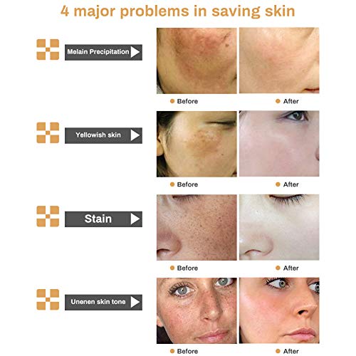 Crema blanqueadora, crema iluminadora, crema aclaradora, tratamiento facial antienvejecimiento para hiperpigmentación, tono de piel desigual, puntos oscuros y daños del sol, 30 ml