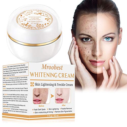 Crema blanqueadora, crema iluminadora, crema aclaradora, tratamiento facial antienvejecimiento para hiperpigmentación, tono de piel desigual, puntos oscuros y daños del sol, 30 ml