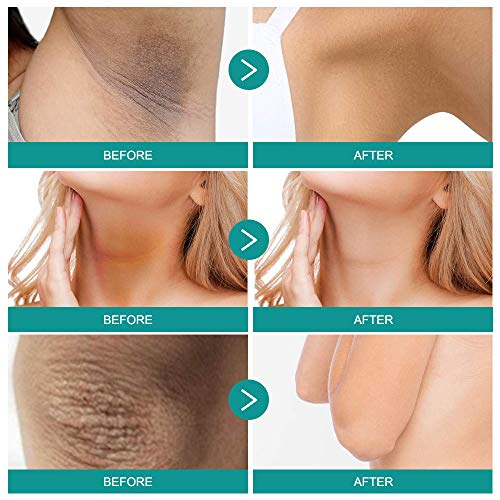 Crema Blanqueadora Para Las Axilas, Crema Para Aclarar Eficaz Para Axilas, Cuello, Rodilla, Codo, áreas Sensibles Y Privadas, Ilumina, Nutre, Hidrata, Repara Y Restaura La Crema Para Blanquear La Piel