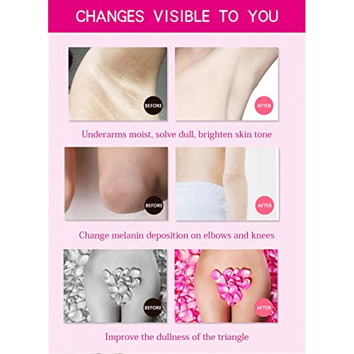 Crema blanqueadora para piel oscura, cuello, zonas sensibles, codos, muslos interiores, rodillas y axilas, crema para el cuidado de la piel