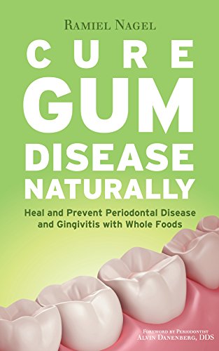 Cure Gum Disease Naturally: Heal and Prevent Periodontal Disease and Gingivitis with Whole Foods (English Edition)