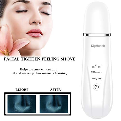 DigHealth Limpiador Facial Ultrasonico, Skin Scrubber Profesional con Función de Masaje Facial, Peeling Ultrasonico para Eliminación de la Espinilla y Limpiador de Poros, 4 Modos