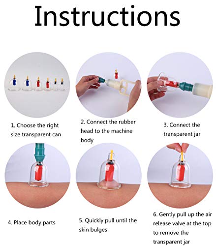Dispositivo de ventosas de Vacío, succión del tipo de sangre estasis Succionamiento Dispositivo, Inicio Volver masajeador conjunto, el Dispositivo Inicio ventosas de Vacío