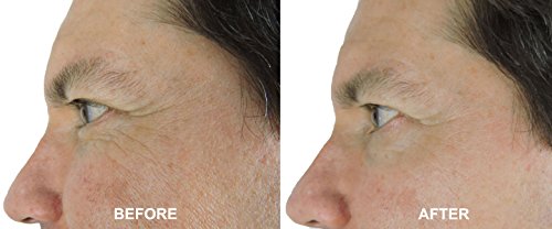 DNA Code- 20% Glycolic Acid Complex Collagen Reubild Cream w/ Argireline,Matrixyl 3000, CoQ10 by DNA CODE Skin Care