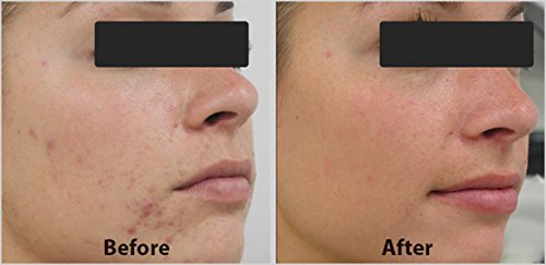 DNA Code- 20% Glycolic Acid Complex Collagen Reubild Cream w/ Argireline,Matrixyl 3000, CoQ10 by DNA CODE Skin Care