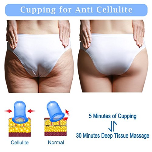 Edealing 1PCS Pequeño Copas cuerpo anti celulitis de vacío de silicona masaje con ventosas Copas Cuidado de la Salud