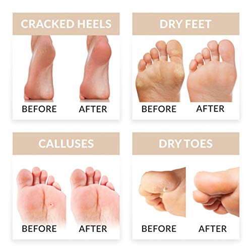 Exfoliante pies quita callos pies calcetines exfoliantes de pies mascarilla pies peeling babyfoot baby foot elimina callos, 2 pares