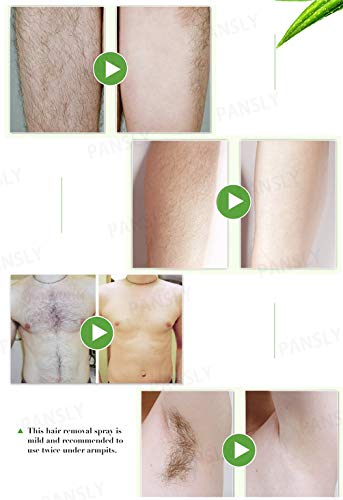 FFOMG Bareit Spray depilatorio, Stop Spray inhibidor del Crecimiento del Vello, Cuerpo sin Dolor Piernas Axilas Manos Esencia depilatoria Facial, Depilatorio Facial instantáneo y sin Dolor (2 Piezas)