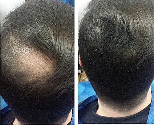 Fibras Capilares (Rubio, 22 g) Fibras de queratina para adelgazar las zonas de calvicie | Mire más joven, más grueso, más completo: tratamiento de pérdida de cabello con recrecimiento temporal