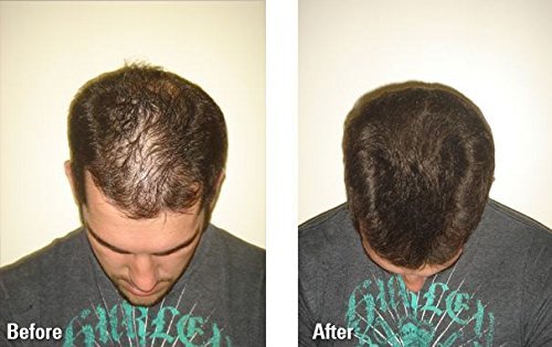 Fibras Capilares (Rubio, 22 g) Fibras de queratina para adelgazar las zonas de calvicie | Mire más joven, más grueso, más completo: tratamiento de pérdida de cabello con recrecimiento temporal