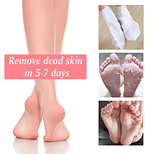 Foot Peel Mask 3 Pack, Removedor de Callo Exfoliante y Piel Seca, Obtenga Pies Suaves para Bebés en 1 Semanas para Hombres y Mujeres (Melocotón)