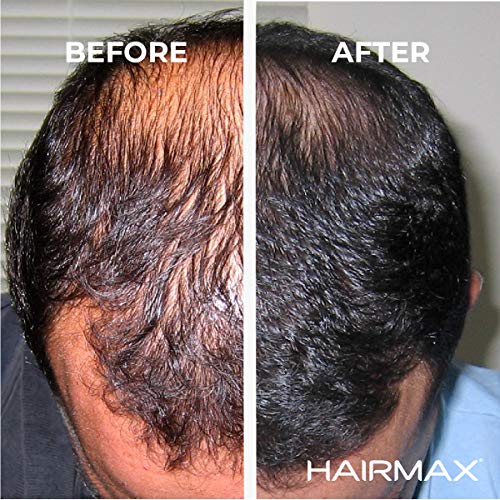 HairMax Dispositivo de crecimiento del pelo de Laserband 82