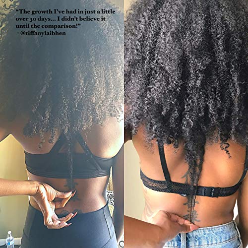 Healthy Hair, Vitamina Para El Crecimiento Del Cabello por Elanveda | Suplemento Vegano y Totalmente Natural Para La Pérdida De Pelo o Adelgazamiento Del Pelo | 60 Cápsulas