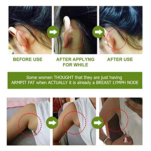 Herbal Lymph Care Patch, Cuello Parche De Desintoxicación Linfático, Hierbas para el cuidado linfático, Ayuda a Quitar Las Axilas Limpiar La Grasa Pérdida De Peso.