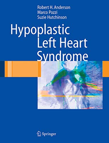 Hypoplastic Left Heart Syndrome (English Edition)